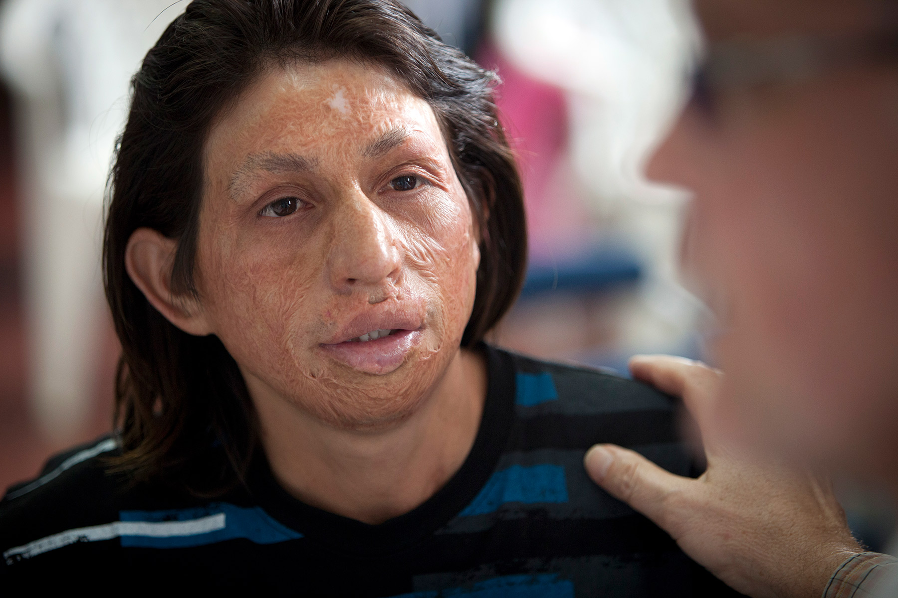 26_care_for_skin_peru_resurge